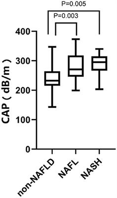 Transient Elastography in the Diagnosis of Pediatric Non-alcoholic Fatty Liver Disease and Its Subtypes